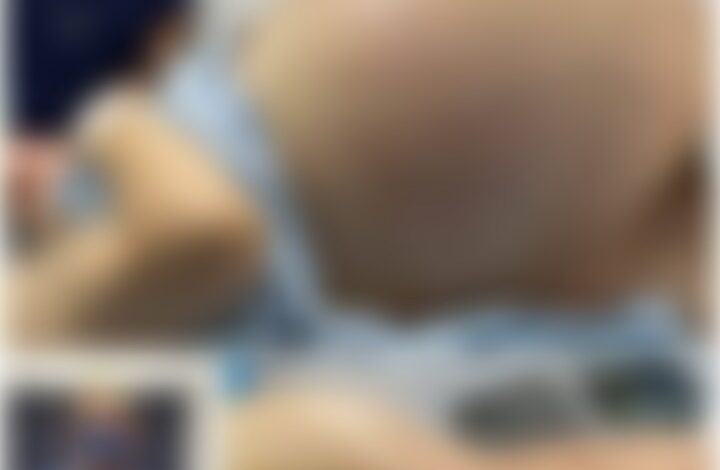 Tears of Joy Turn to Shock! A Pregnant Woman Expecting Triplets Leaves Doctors Stunned by Terrifying Discovery During C-Section