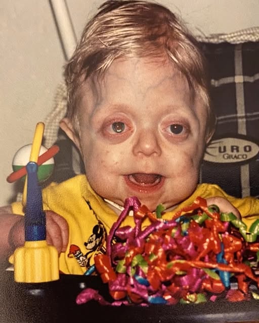 Teen who was not expected to live 18 months graduates high school