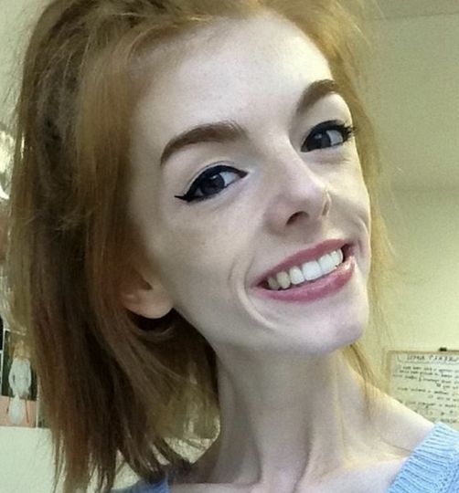 This young woman only ate one piece of bread a day for 5 years, Now grab a tissue before you see her today