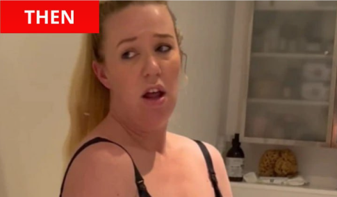 Her Belly Looked Impossible! Then Doctors Saw the Truth and Froze