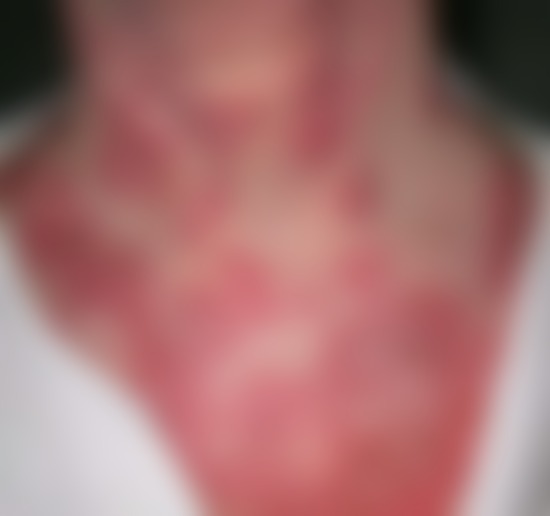 Urgency – These are the consequences of sleeping co! See more – SOTD!