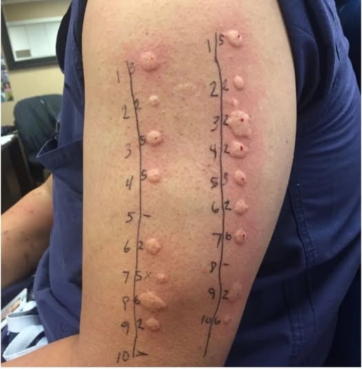 These are the consequences of sleeping co! See more?