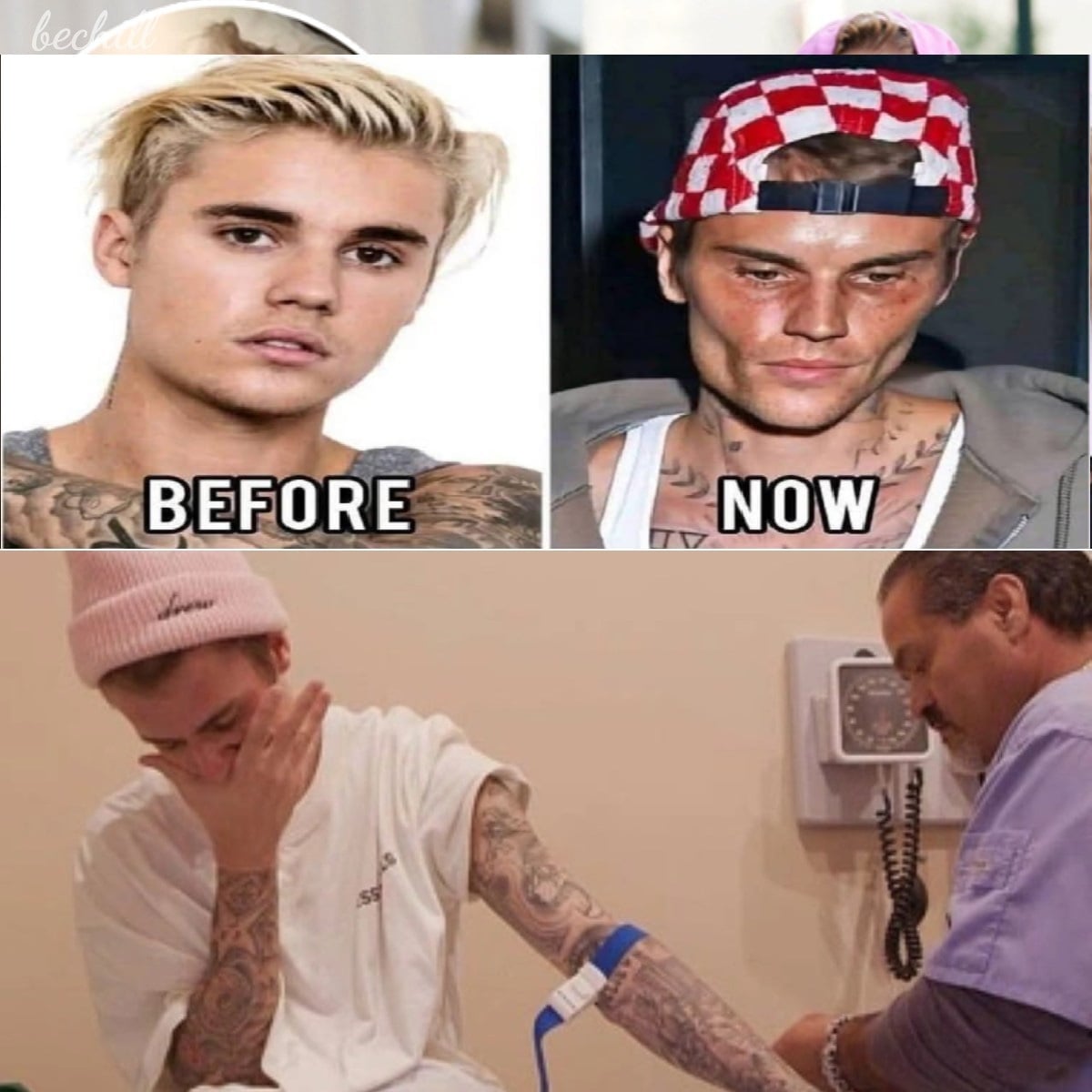 Justin Bieber admits that he tested positive for! See it!