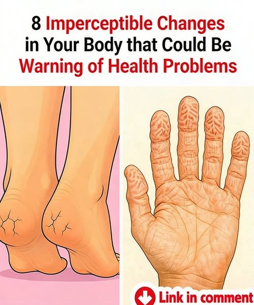 8 Imperceptible Changes in Your Body that Could Be Warning of Health Problems!
